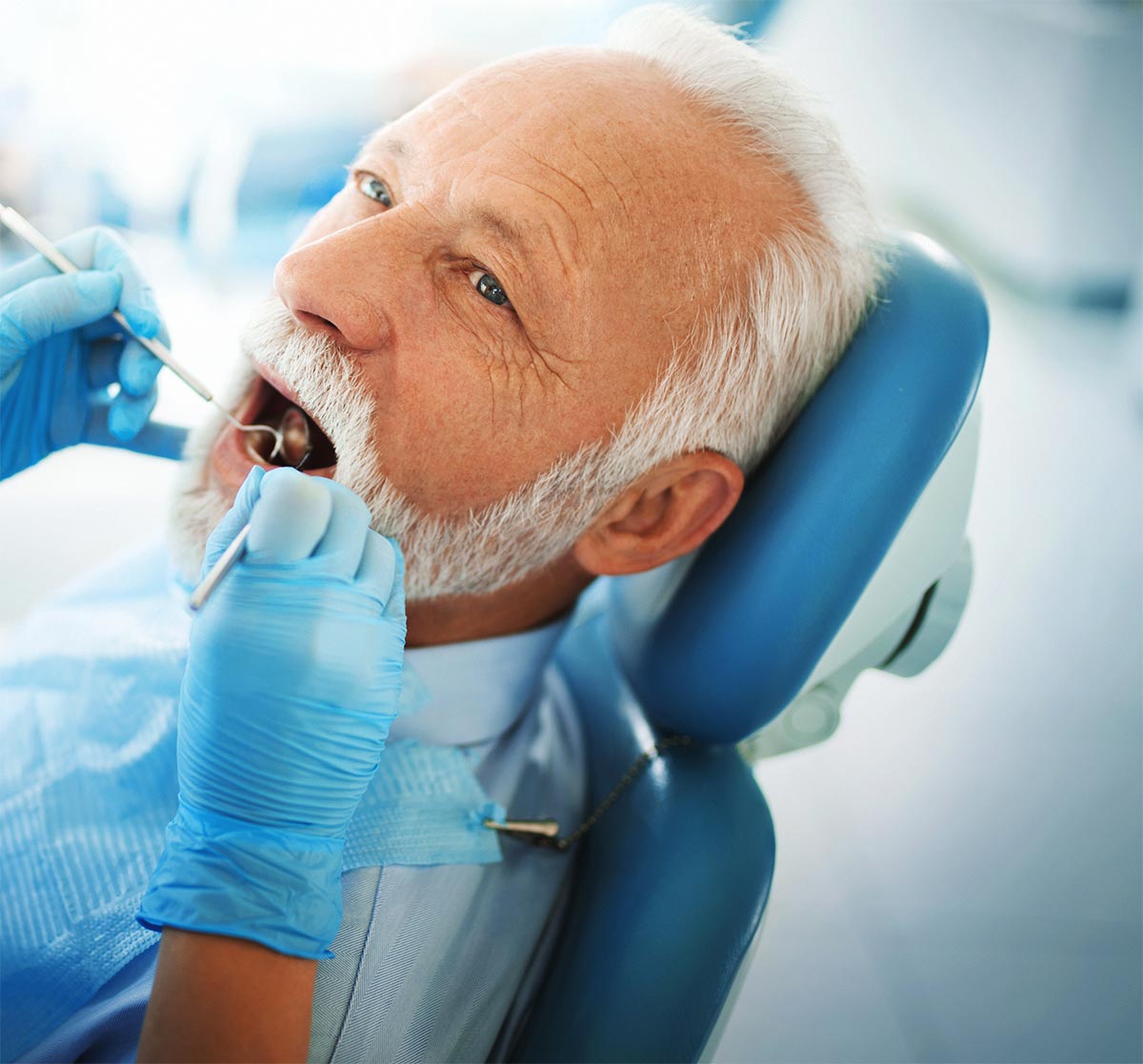 Fillings