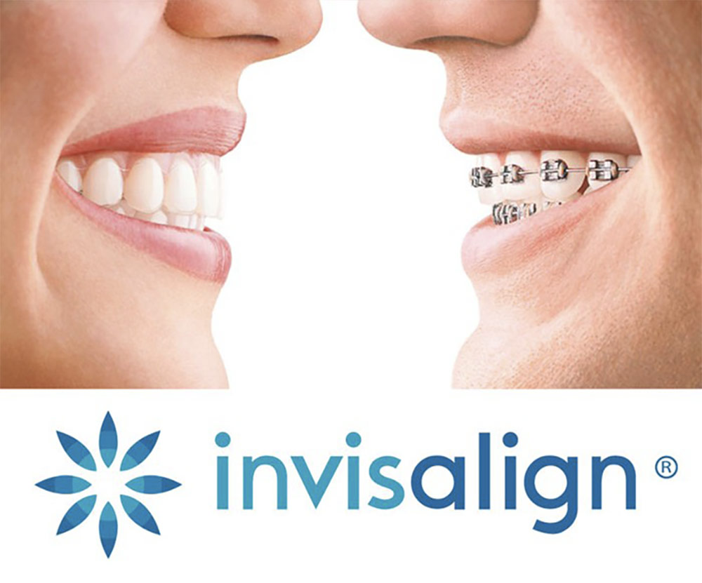 https://www.kacdental.com/wp-content/uploads/2022/10/invisalign-logo-KAC2.jpg